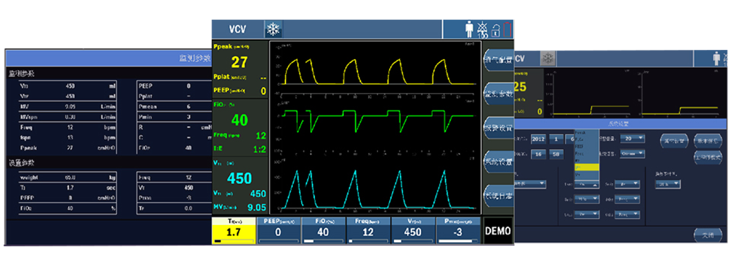 BETWAY(ķ)ٷվ-West Ham United